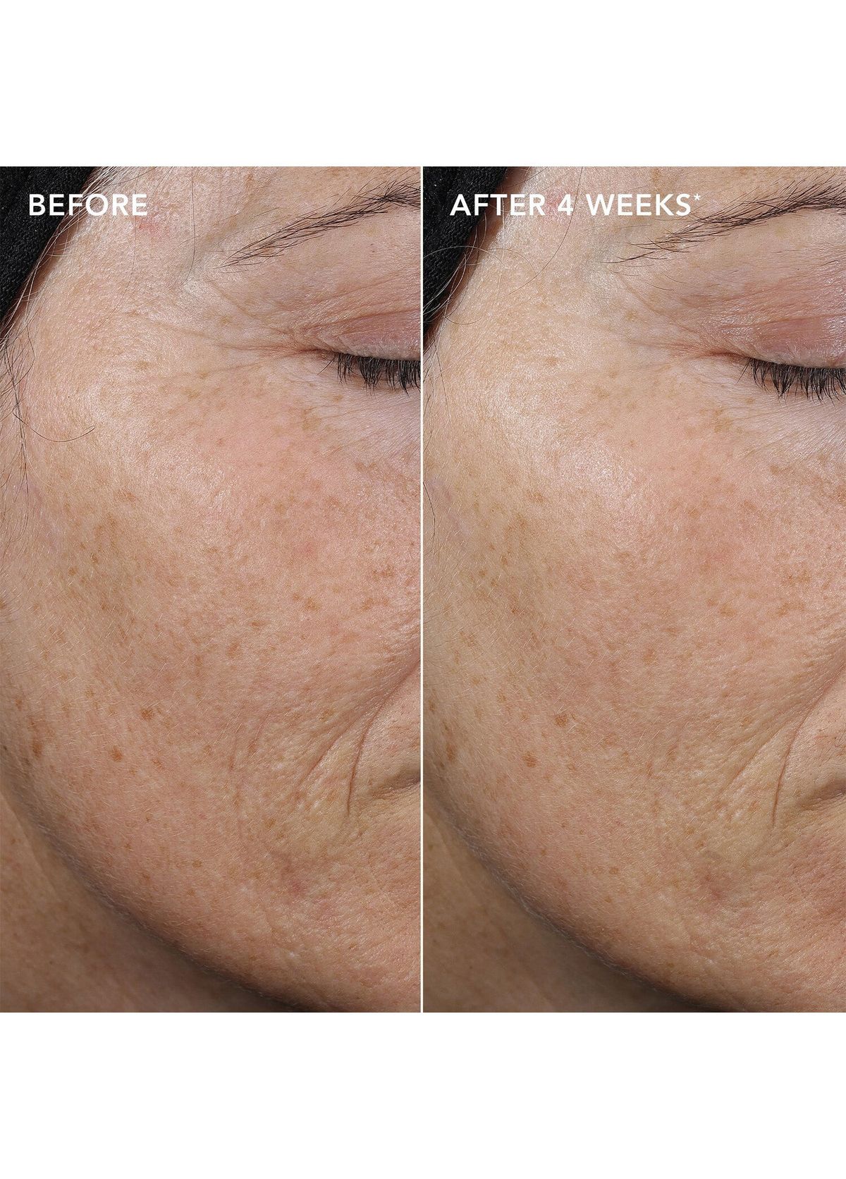 Image Skincare Ageless+ Retinol Pure Liquid Retinol 0.3% Skin Serum 30 ml - 3