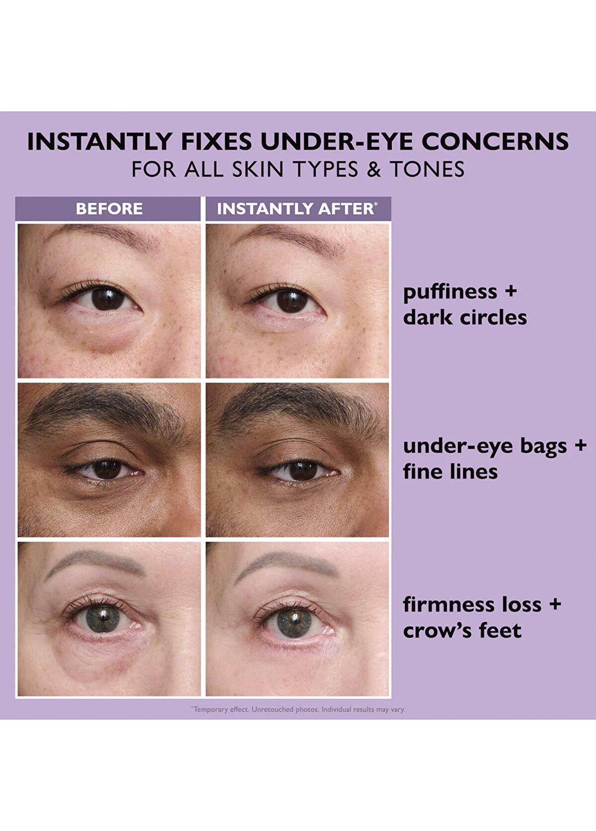 Peter Thomas Roth Instant FIRMx Eye Temporary Eye Tightener Easy-Wear Formula Yaşlanma Karşıtı Göz Kremi 20 ml + Fırça Seti - 3