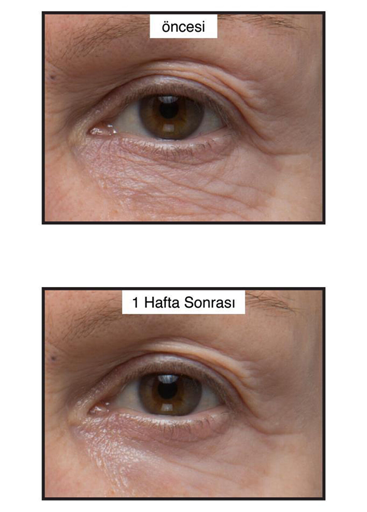 Murad Kırışıklık ve Koyu Renkli Halkalarda Etkili Göz Kremi 15 ml - 3