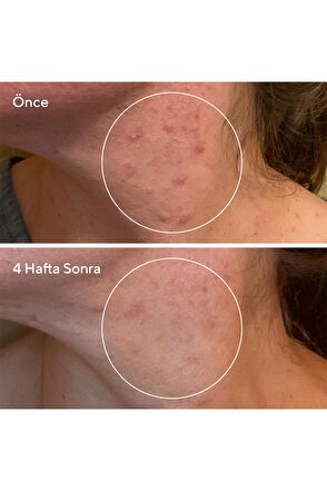 Murad Rapid Relief Fast-Acting Purifying Sulfur Mask 74 ml - 6