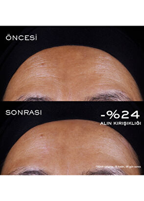 Lancome Rénergie Triple Serum Retinol 50ml - 5