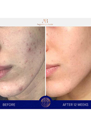 Augustinus Bader Moisturizing Cream 30 ml - 9