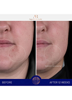 Augustinus Bader The Rich Cream 100ml - 11