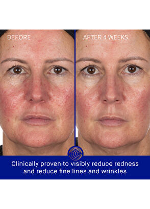 Augustinus Bader The Hydrogel Face Mask 30 gr - 3