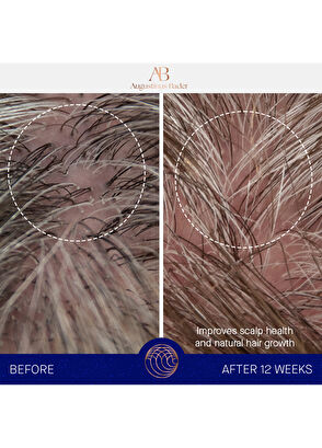 Augustinus Bader The Conditioner 150ml - 7