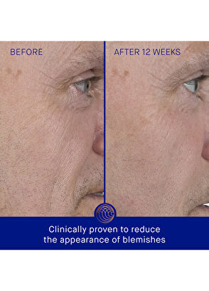 Augustinus Bader The Serum 15 ml - 9