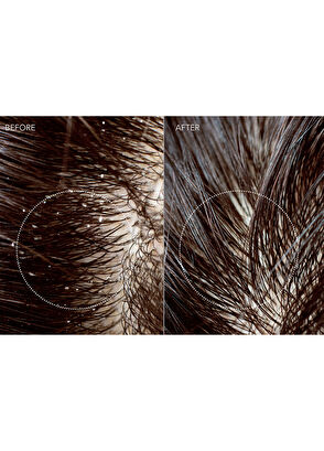 Foreo FAQ Saç Derisi ve Saç İçin Probiyotik Serum - 10