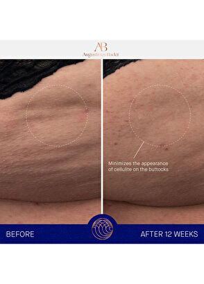 Augustinus Bader The Body Cream 100 Ml - 9