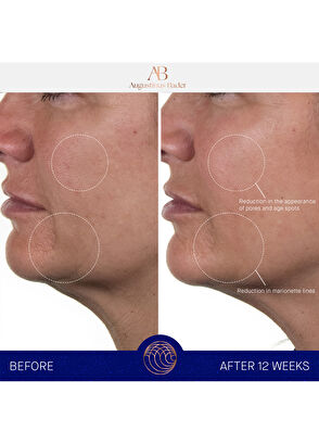 Augustinus Bader The Rich Cream 100ml - 10