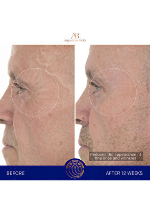 Augustinus Bader The Retinol Serum 15ml - 8