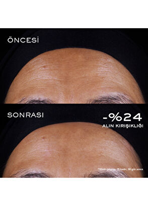 Lancome Rénergie Triple Serum Retinol 20ml - 5