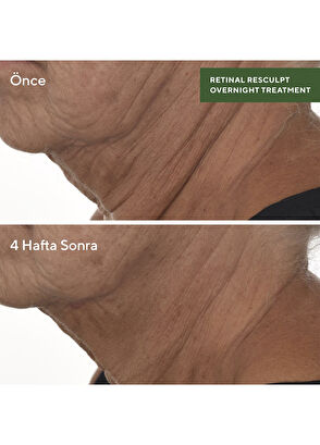 Murad Retinal Resculpt Overnight Treatment - Retinal İçeren Yenileyici Mucize Gece Serumu - 6