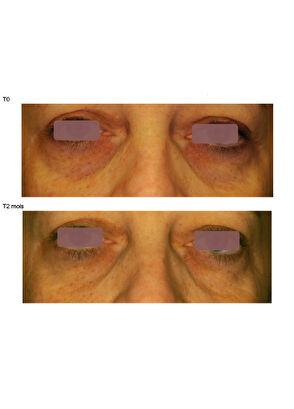 Talika Eye Quintessence - 14