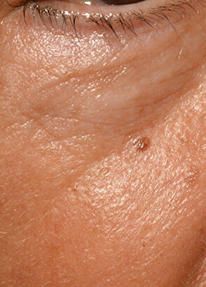 Talika CİLT BAKIM CİHAZI - 7