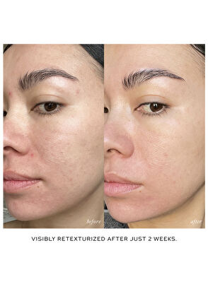 Westman Atelier Skin Activator Rollerball - 3