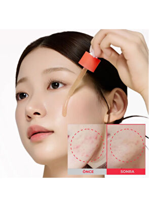Sungboon Editor Red Heartleaf BHA-Lino Dengeleyici Ampul Cilt Serumu 40 ml - 6