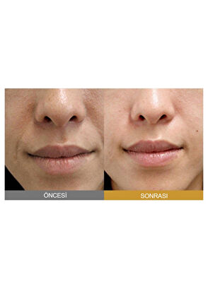 Sungboon Editor Silk Peptide Intensive Lifting Ampoule İpek Peptitleri Ve Kolajen İçeren Sıkılaştırıcı Ampul Cilt Serumu 35 ml - 5