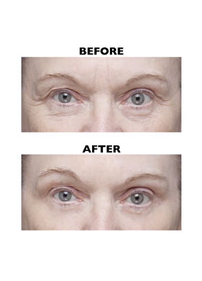 Peter Thomas Roth Instant FirmX Eye Göz Kremi 30 ml - 6