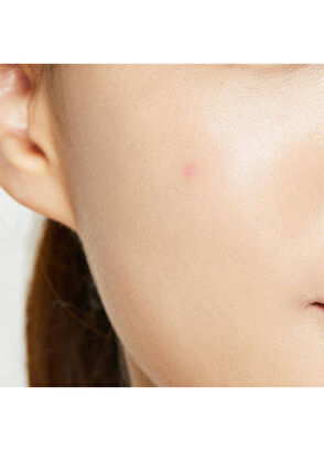 Cosrx Acne Pimple Master Patch 24'lü Akne Söndürücü Şeffaf Sivilce Bandı - 3