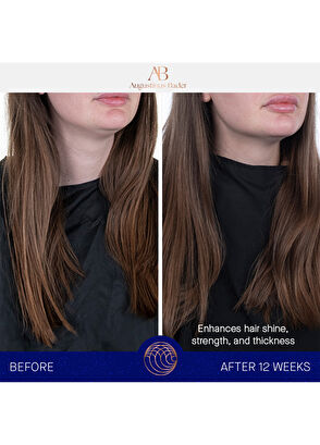 Augustinus Bader The Conditioner 150ml - 8