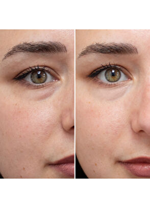 Talika Eye Therapy Patch Collector - 14