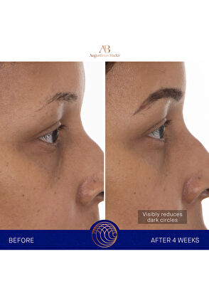 Augustinus Bader The Eye Patches Row - 15