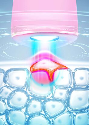 Foreo Espada 2 Pearl Pink - 3