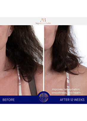 Augustinus Bader The Leave-İn Hair Treatment 100ml - 7