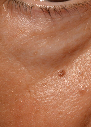 Talika CİLT BAKIM CİHAZI - 6