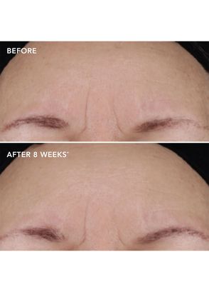 Image Skincare Ageless+ Retinol Treatment Crème 1.2% Retinol Complex Anti-Aging Face Cream 28.5 gr - 5