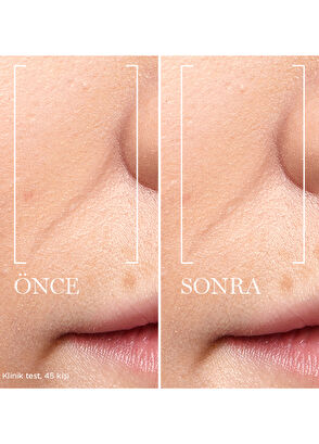 Lancome Renergie Triple Serum 20 ml - 4