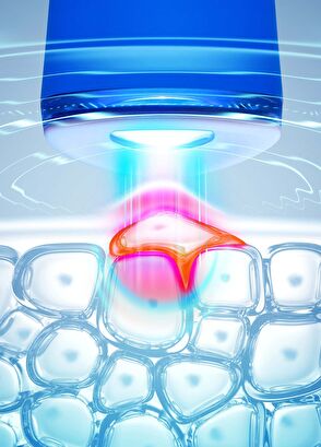 Foreo Espada 2 Blue Skin Care Device - 3