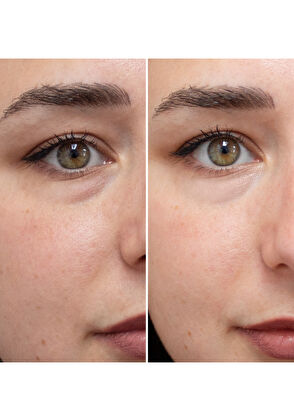 Talika Eye Therapy Patch Solo - 15