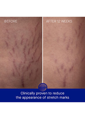 Augustinus Bader VÜCUT NEMLENDİRİCİ - 8