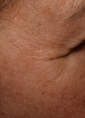 Talika CİLT BAKIM CİHAZI - 9