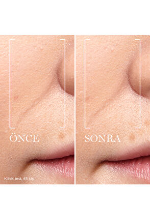 Lancome Renergıe Trıple Serum 50Ml - 5