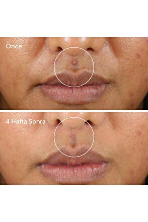 Murad Rapid Relief Fast-Acting Purifying Sulfur Mask 74 ml - 5