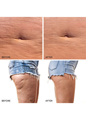 Foreo Bear 2 Body Evergreen Body Massager - 6