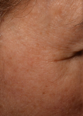 Talika CİLT BAKIM CİHAZI - 8