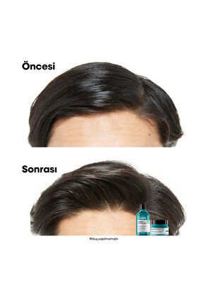 Loreal Professionnel Serie Expert Scalp Advanced Yağlanma Karşıtı Profesyonel Şampuan 500 ml - 5