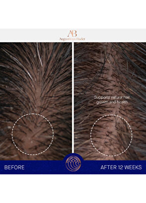 Augustinus Bader The Conditioner 150ml - 9