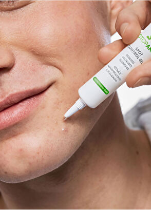 Babe Stop Akn Spot Control Gel Acne Drying Gel 10 ml - 3
