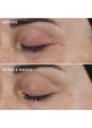 Image Skincare Ageless+ Retinol Repair Crème 0.3% Retinol Complex Anti-Aging Face Cream 50 g - 5