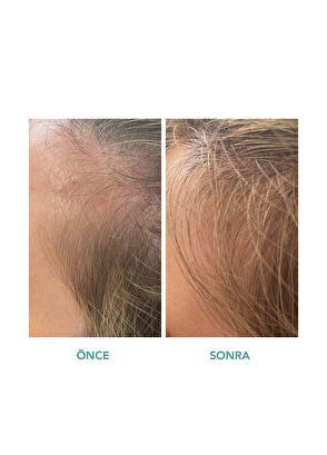 We Are Paradoxx Growth Thickening 250 ml Saç Kremi - 8