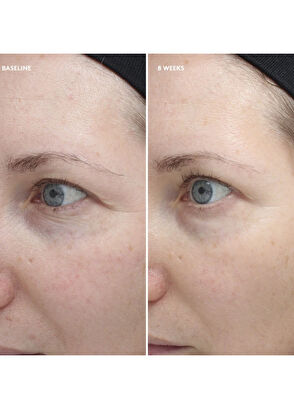 Colorescience Total Eye Sıkılaştırıcı & Onarıcı Göz Çevresi Kremi 18 ml - 5