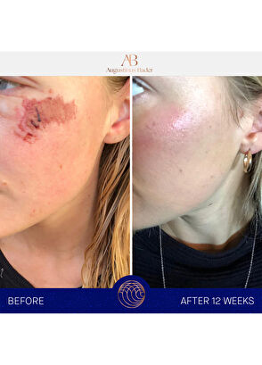 Augustinus Bader Nemlendirici Krem 15 ml - 8