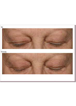 Talika Eye Quintessence - 13