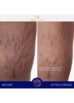 Augustinus Bader The Body Cream 200 ml - 6