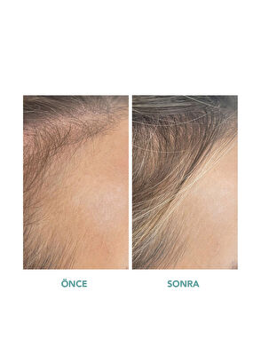 We Are Paradoxx Growth Thickening 250 ml Saç Kremi - 10