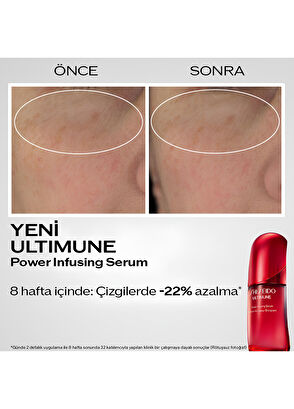 Shiseido Ultimune Power Infusing Concentrate Serum 30Ml - 5